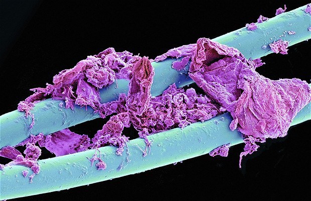 Использованная зубная нить - 30+ Фотографий под Микроскопом