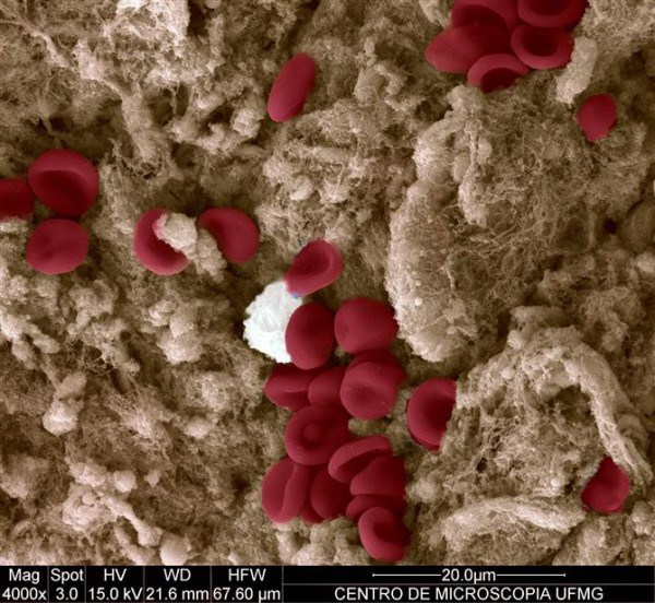 Частички крови на порезе - 30+ Фотографий под Микроскопом