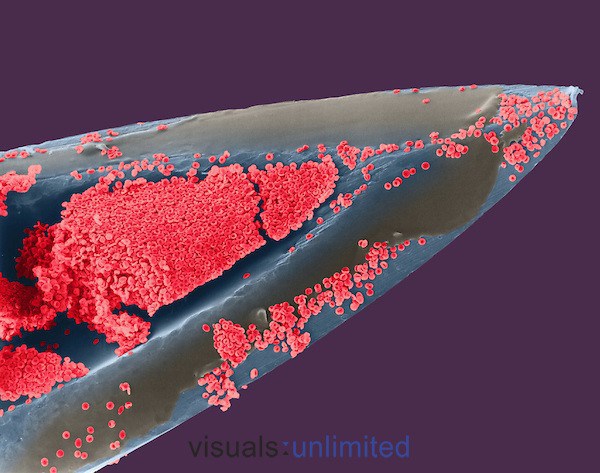 Игла для подкожных инъекций с частичками крови - 30+ Фотографий под Микроскопом