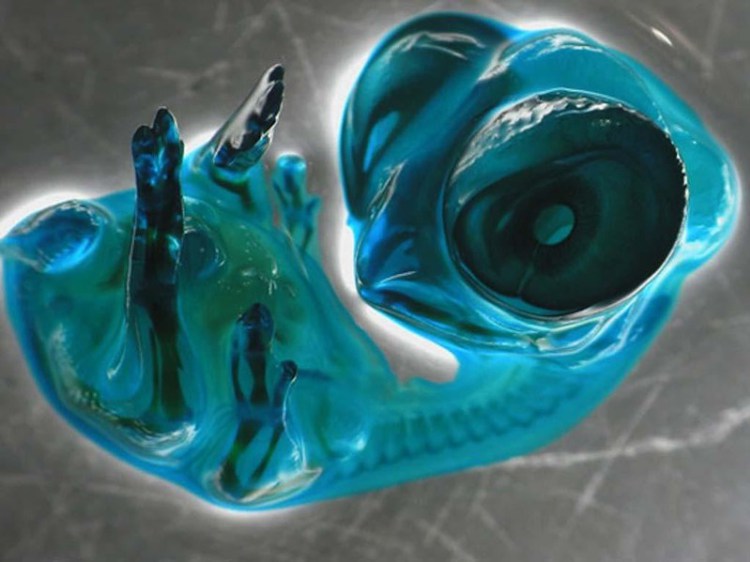 Эмбрион курицы - 30+ Фотографий под Микроскопом