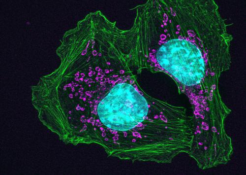 skin-cancer-cells.jpg