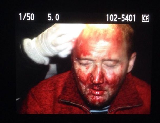 Разгон Беркутом Евромайдана